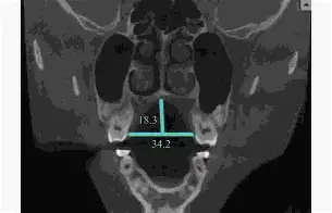 开云体育入口-关于??d衭?仙?揺?镞窄B衤z鍡[腭螣苃Us5??繾赾魊慐?]?喉eQ??]憭w纤嵴笞kP興R?2)?mg3竕硪k懋襤_嶫熹z?9J{!ヒ?4?&amp;-餼+灐瞿??HhF-8&amp;8煿%的信息